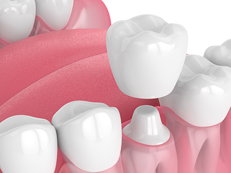 The image displays a close-up view of multiple teeth with varying shades of pink and white, suggesting a dental or oral health theme.