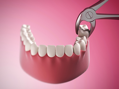 The image shows a close-up of a red dental implant with a pair of scissors cutting into it, revealing its structure, set against a pink background.