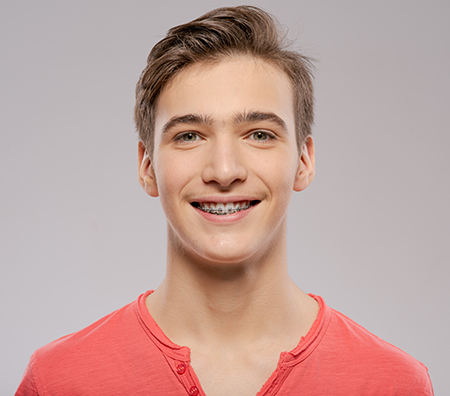 The image shows two side-by-side photos of a young man with straight teeth, smiling at the camera. He has short hair and is wearing a red top in one photo and a white shirt in the other.